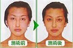 美容整体によるシンメトリー整顔施術