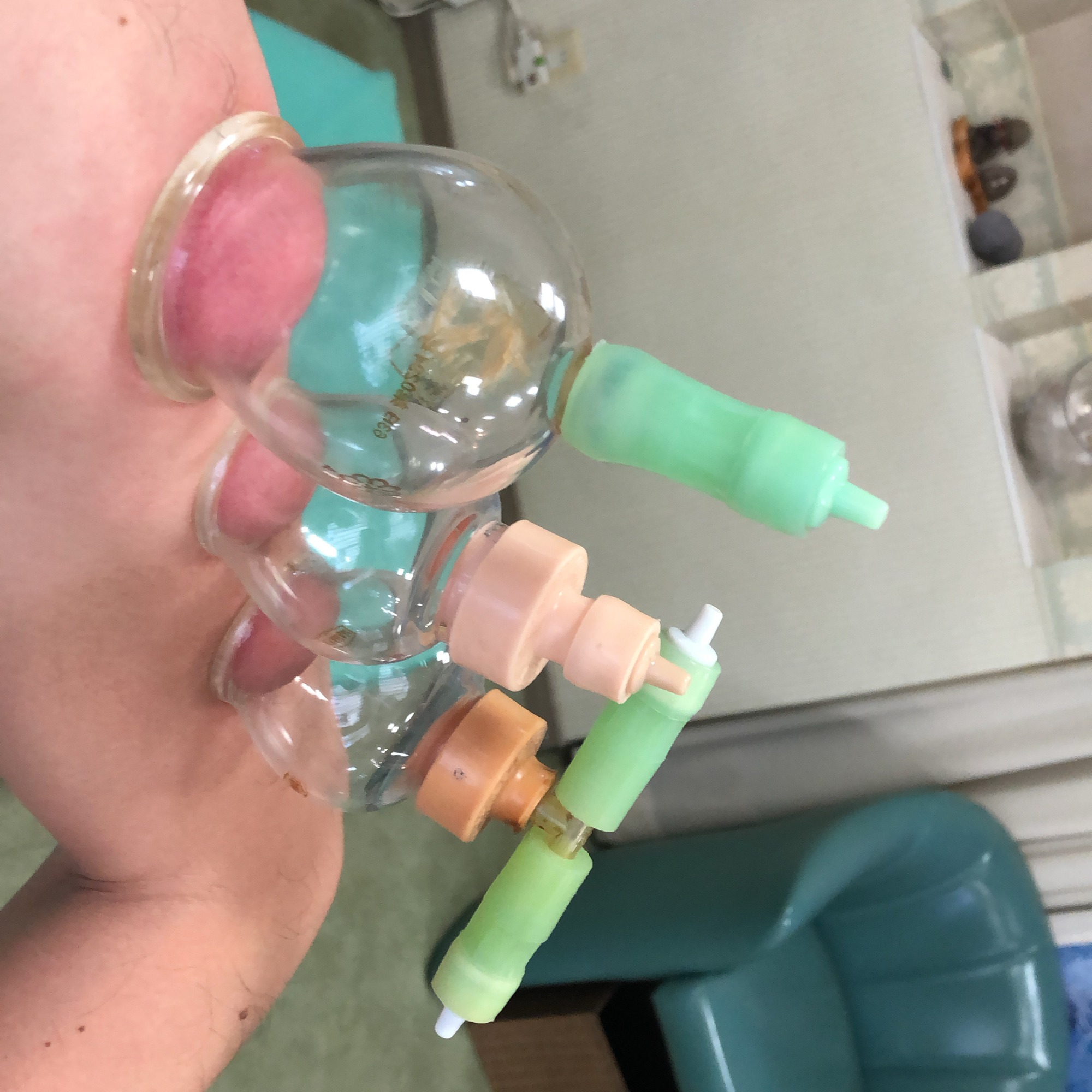 カッピング施術もできる整体院